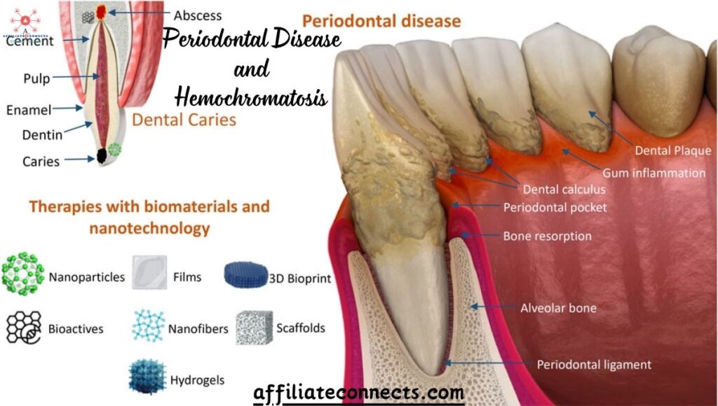 Periodontal Disease and Hemochromatosis