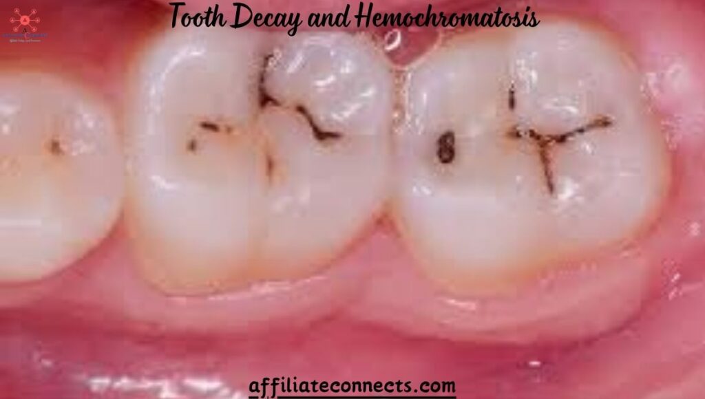 Tooth Decay and Hemochromatosis