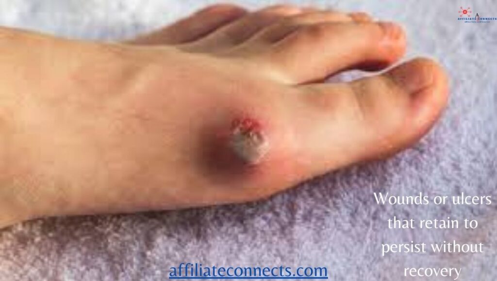 Why Do People Lose Their Finger and Toes with Diabetes