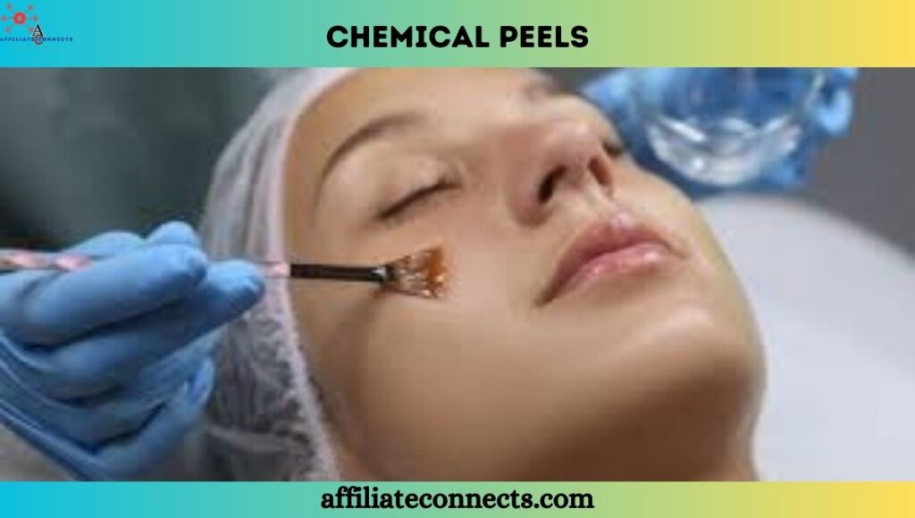 Chemical peels chemical solution of scrapping off