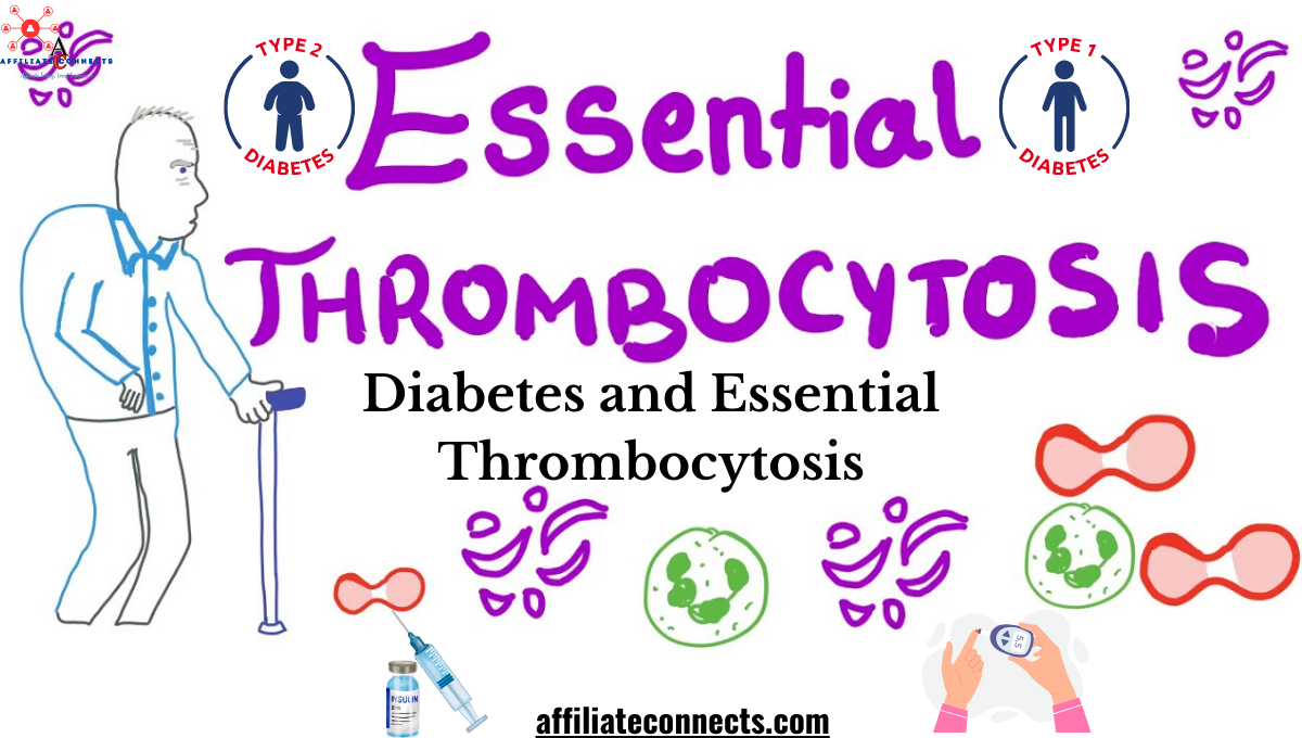 Diabetes and Essential Thrombocytosis