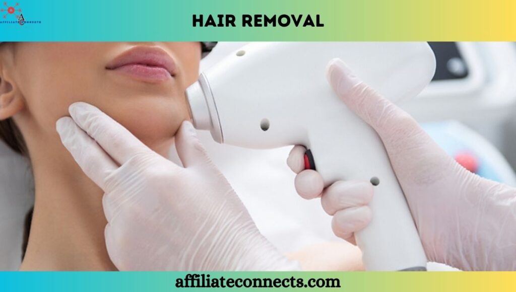 Laser hair removal: Popular Beauty Treatment Names