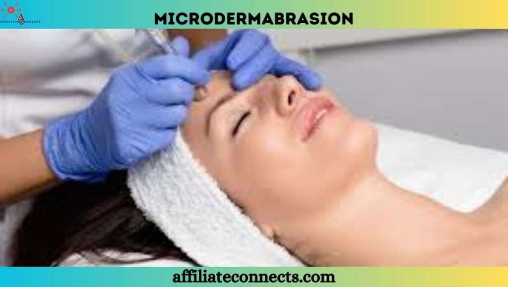 Microdermabrasion is a moderate therapy